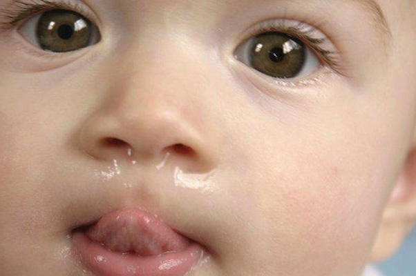 Runny And Blocked Nose A Sign Of Nasal Allergy Problems ENT Clinic